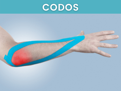 https://enzuo8krbya.exactdn.com/wp-content/uploads/2022/02/Tratamientos-Fisioterapia-Codos-1.png?strip=all&fit=400%2C300&lossy=1&ssl=1